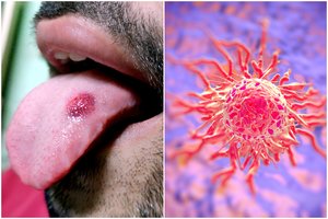 Klastingos ligos neįtarė net gydytojai: verslininką išgelbėjo greita reakcija į neįprastą simptomą