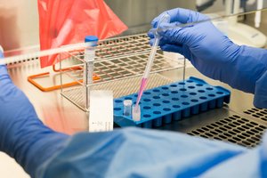 Laboratorija jau skirsto gautus 120 tūkst. greitųjų antigeno testų