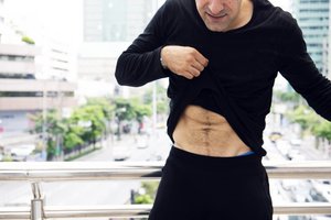 Pilvo plastika vyrams preso nepadovanos, bet formas sugrąžins