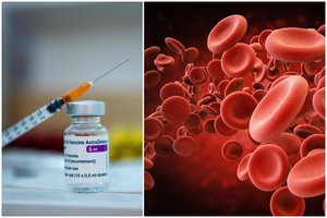 Vaistų kontrolieriai gavo dar vieną pranešimą apie kraujo krešulius: aiškinasi, ar susiję su „AstraZeneca“ vakcina