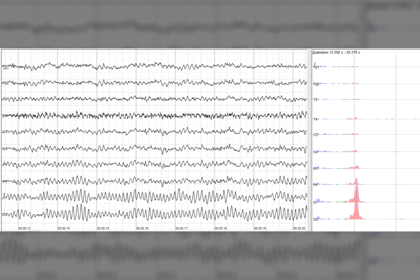  EEG pavyzdys, matomos alfa bangos.<br>Wikimedia commons
