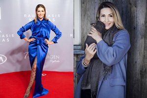 Specialistė atskleidė, kaip savo grožį yra patobulinusi Daina Bosas