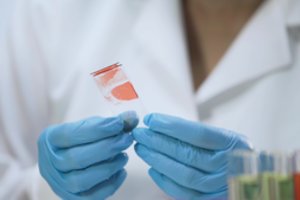 Hemofilija – šiandien tai nėra nuosprendis, kad žmogus nukraujuos: su ja galima išmokti gyventi