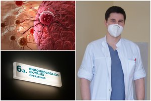 Onkologas prabilo apie rimtą lietuvių bėdą: pasekmės gali būti itin skaudžios