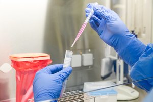 Laboratorija turi 180,8 tūkst. serologinių greitųjų testų, daugiau įsigyti kol kas neplanuojama