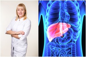Kas penktas lietuvis serga nebylia kepenų liga: gydytoja pasakė, kokių klaidų nedaryti