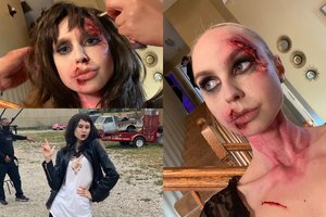 Ant Simonos Milinytės veido – randai: kardinaliai pakeitė įvaizdį