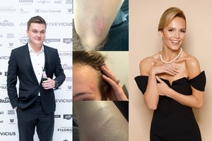 Pauliaus Aršausko mylimoji prabilo apie iš jo patirtą fizinį smurtą: „Mėlynės tik lašas jūroje“  