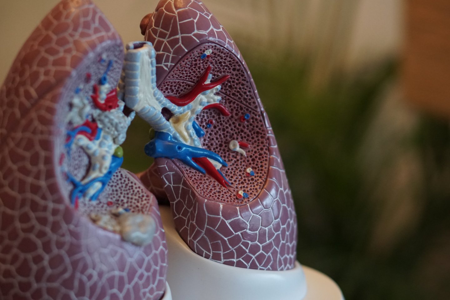 KTU alumnų įkurtame startuolyje KTU mokslininkai kuria neinvazinį plaučių ligų tyrimo sistemos prototipą.<br>Unsplash nuotr.