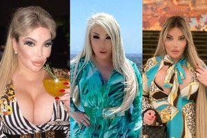 J. Alves – sunkiai atpažįstama: veido bruožai keičiasi ne mėnesiais, o savaitėmis 