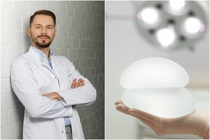 Koks iš tiesų krūtų implantų „tarnavimo“ laikas, ir kokios bėdos laukia laiku jų nepasikeitus