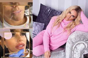 Katie Price gerbėjams parodė, kaip atrodo jos natūralios lūpos: skirtumas akivaizdus