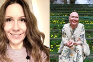 Kaunietė dėl jai negirdėtos ligos neteko plaukų: įmanoma atrasti ir pliusų