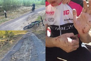 Dviračiu į kurortą – pavojus išsibarškinti dantis: jei takas nebus tvarkomas, traumų vasarą galite ir neišvengti