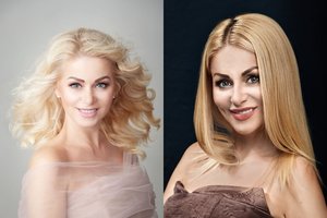 Vaidą Genytę odos problemos vargino nuo paauglystės, o išspręsti jas ryžosi tik dabar