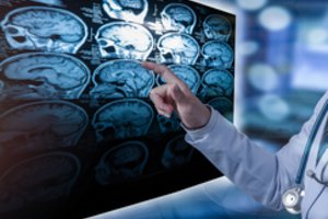 Medikė, tapusi paciente: išgirdus ligos diagnozę, dangus maišėsi su žeme