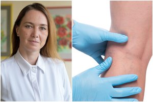 Retas atvejis nustebino net patyrusius Klaipėdos medikus – tokių dalykų nematė ilgus metus