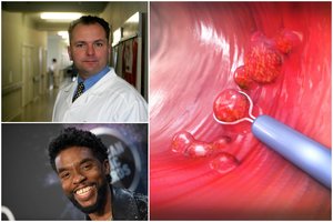 Žymaus aktoriaus gyvybę pasiglemžusi liga kasmet pasikėsina ir į šimtus lietuvių: kaip apsisaugoti?