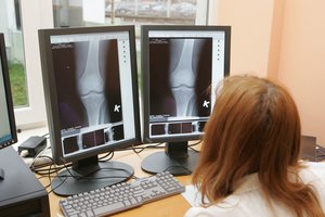 Kuo baigiasi neatsakingas lakstymas dviračiais ir motociklais: atviri lūžiai, stuburo traumos, dalinės amputacijos ir paralyžius