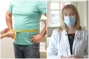 Nutukimas – liga, su kuria susiduria kas penktas lietuvis