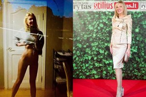 63-ejų Audronė Bunikienė parodė nepriekaištingą figūrą 