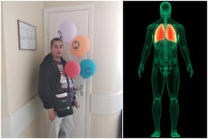 Jaunam vilniečiui netikėtai pritrūko oro: gydytojai savaitę aiškinosi, kas nutiko