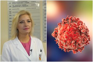 Profesorė paaiškino, kokie žmonės lengviau atlaiko vėžio gydymą: svarbūs keli niuansai