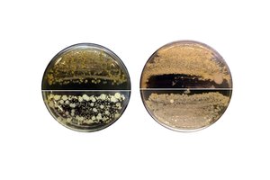 Pirmasis Lietuvoje išmaniųjų higienos tyrimas nustebino: bakterijų ant telefono daugiau nei lifte