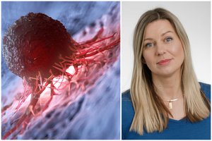 Kelia raudoną vėliavą: Lietuvoje nediagnozuoti tūkstančiai vėžio atvejų, sunkūs susirgimai pasiekė piką