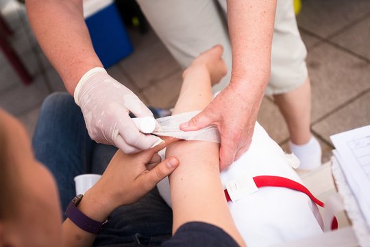 Kupiškyje girta moteris konfliktą su vyru sprendė dantimis ir nagais