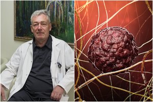 Gydytojas įvardijo, kaip galima atpažinti agresyvų vėžį: perspėjo dėl klaidingo mito