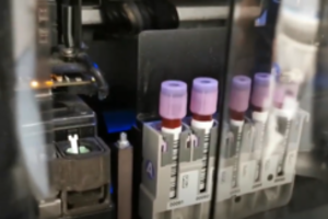 Santaros klinikos tirs rūpestį keliančias atmainas kartu su kitomis pasaulio laboratorijomis