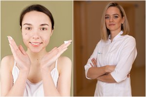 Su kokiomis pasekmėmis gali tekti dorotis netinkamai prižiūrint veido odą?