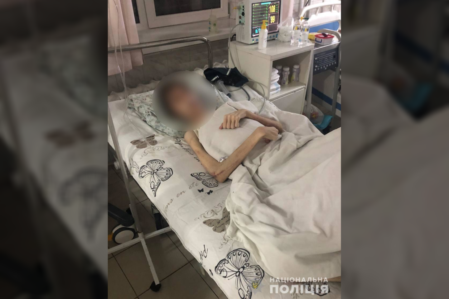 Pažymima, kad tėvas kreipėsi į gydytojus tik tada, kai išsekęs vaikinas net negalėjo gerti vandens.<br>Ukrainos policijos nuotr.