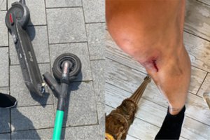 Sulūžus paspirtukui Lietuvos čempionas patyrė skaudžią traumą: nustebino pasiūlyta 0,31 euro kompensacija