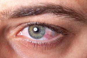 Nekaltas akių ašarojimas buvo tik pradžia: toliau prasidėjo tikra kankynė