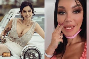 Į Turkiją ilsėtis vyksta ne visi: lietuviškoji Kim Kardashian ten kreipėsi į gydytojus