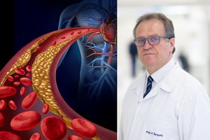 Profesorius ragina išmokti auksinę taisyklę: padės apsisaugoti nuo didelio cholesterolio kiekio