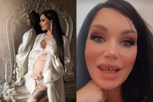 Savo šypsenos gėdijųsis lietuviškoji Kim Kardashian kreipėsi į Turkijos specialistus: parodė rezultatą