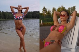 Indrė Burlinskaitė apie netobulą įdegį: po atostogų Turkijoje – pasekmės matyti iki šiol