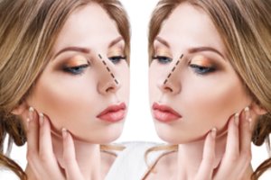 Iškrypusi nosies pertvara: vienas klausimas parodys, ar jums reikia operacijos