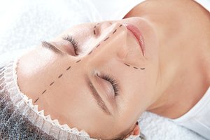 Plastinių operacijų istorija: nuo karo aukų ir garsiausio atvejo Lietuvoje