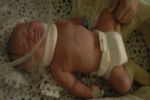 Pagimdžiusi kūdikį vilnietė liko nežinioje: „Jam atliko gausybę tyrimų, bet nesakė, kodėl“