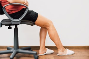 Ką reikėtų žinoti apie venų varikozės gydymą?