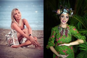 Gerda Žemaitė prakalbo apie dar vieną jai atliktą plastinę operaciją