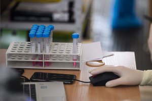 SAM paaiškino, ką reikėtų daryti, moksleiviui sulaukus teigiamo COVID-19 rezultato