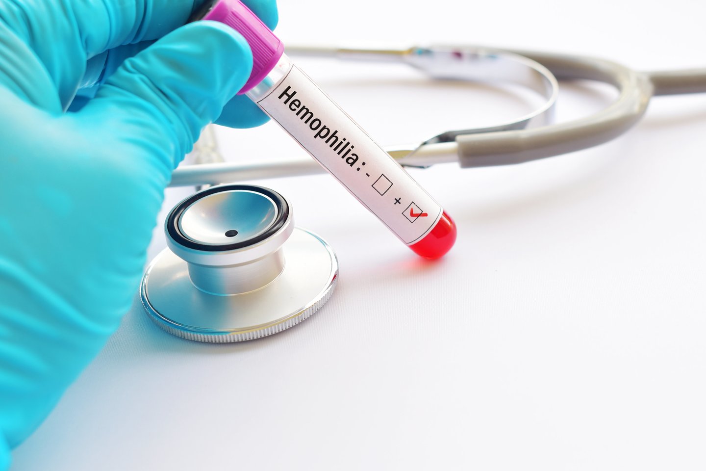 Hemofilija yra paveldima liga, kuria susirgusiam žmogui kraujas kreša kur kas lėčiau arba iš viso nekreša.<br>123rf nuotr.