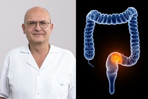 Itin klastingas vėžys kasmet pražudo arti tūkstančio lietuvių: daktaras pasakė, kokie ženklai įspėja apie ligą