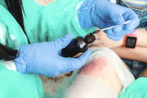 Kaip ir kada žmonės išmoko dezinfekuoti žaizdas?