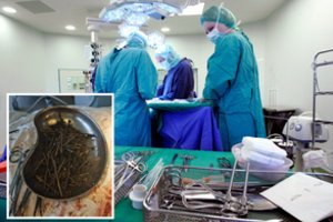 Kilogramą svetimkūnių iš skrandžio pašalinę medikai: yra traukę metalines monetas, bet tokio radinio dar nebuvo